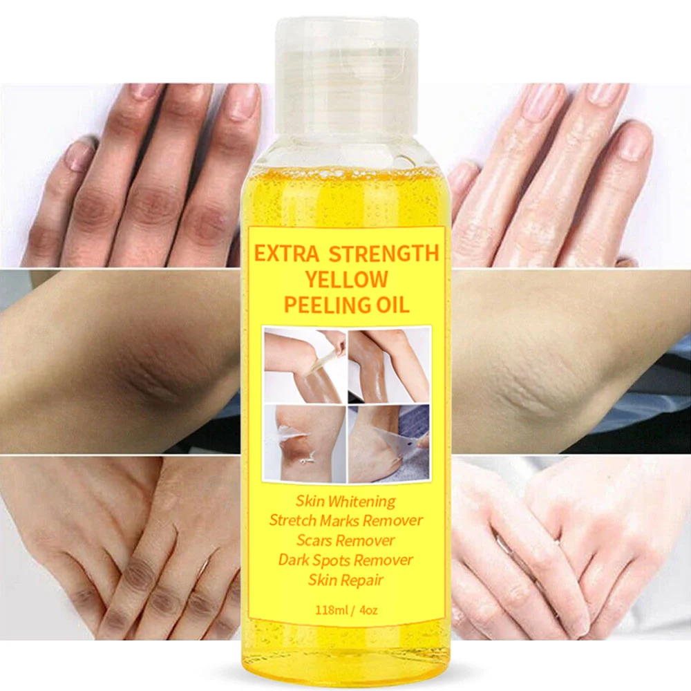 Strong Skin Whitening Lightening